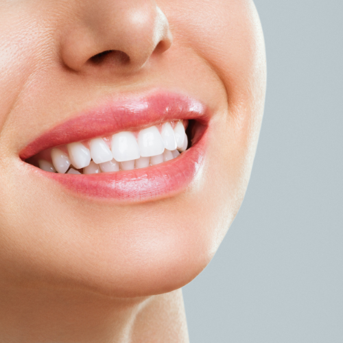 Do you need sedation for dental implants?